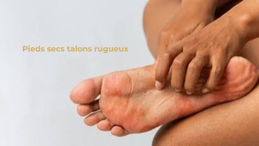 Pieds secs talons rugueux Pieds secs avec talons rugueux et zones plus foncées